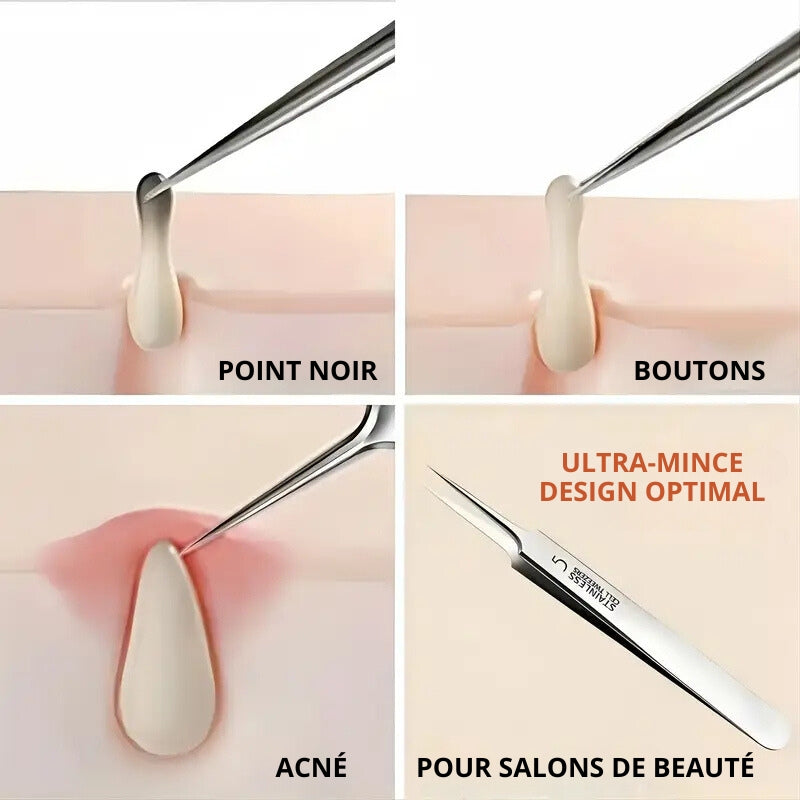 Set de Pinces à épiler pour acné et points noirs